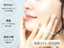 マイルーチェ 可児川合店(MyLuce)の雰囲気(切らないリフトアップ!)