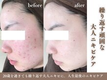 フェイシャル専門店 エピア 掛川店(Epia)