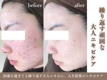 フェイシャル専門店 エピア 掛川店(Epia)