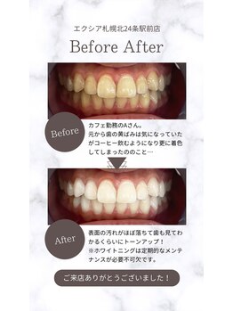 エクシアホワイト 北24条駅前店/