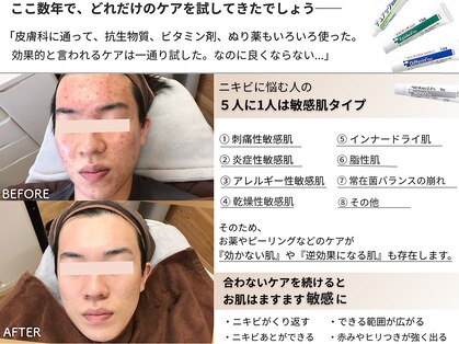 ビアンカの写真