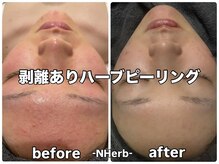 エヌハーブ(NHerb)