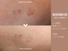 アンドアンド(&and)/大きなシミにも！