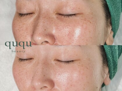 クク(ququ)の写真