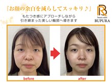 ブプラ つくば店(BUPURA)/before→after　10