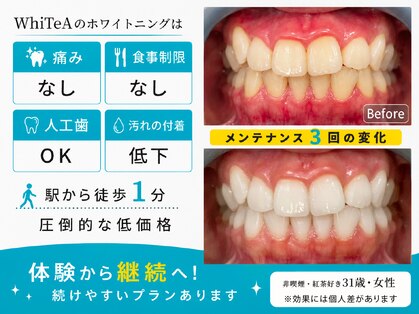 ホワイティア たまプラーザ(WhiTeA)の写真