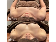 カシェット(cachette)/ミラクルバスト1度の結果