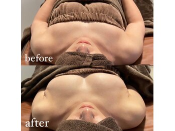 カシェット(cachette)/ミラクルバスト1度の結果