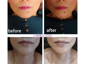 エム(M)/整体 小顔矯正