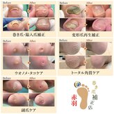 巻き爪補正店 赤羽店