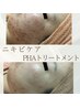 ニキビにお悩みの方◎低刺激のトリートメントから始める肌質改善￥12,000