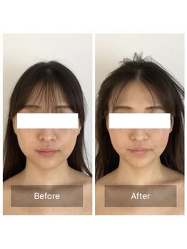 ハリオン 中目黒(HARI-ON)/初回ビフォーアフター