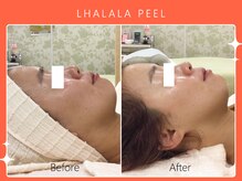 シロカネ イオンタウン西熊本店(SHIROKANE)/ララピール☆