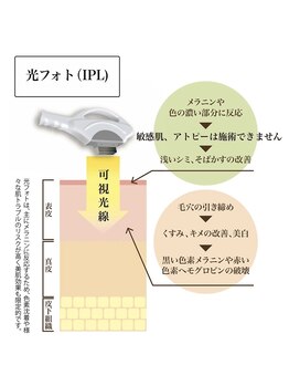 ヘルディン(heldin +555)/光フォトは表面しか当たらない