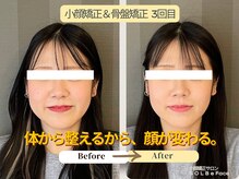 ソルビーフェイス(SOL*BeFace)