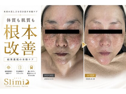 スリミア(Slimia)の写真