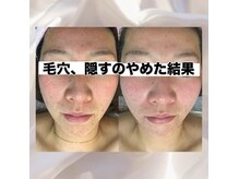 シレーヌ(Sirene)の雰囲気（お化粧を邪魔する毛穴やくすみ！お悩み解消！!肌質改）