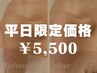 リピNo1【平日限定】角栓・黒ずみ徹底毛穴洗浄×キュッと引き締め導入60分