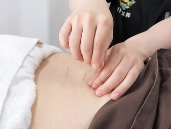 町田きずなはりきゅう整骨院の写真/町田駅近★20時半まで受付OK★首肩こり、腰の筋肉やツボを鍼灸で刺激。身体を熟知した国家資格保有者が施術