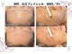 ヴィーナス(Venus)の写真/韓国ピーリング【白玉スキン】ニキビ,シミ,シワ 脂性肌,乾燥肌,敏感肌など、あらゆるお肌をノーフェンデに!