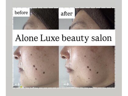 アローネリュクス(Alone Luxe)の写真
