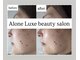 アローネリュクス(Alone Luxe)の写真