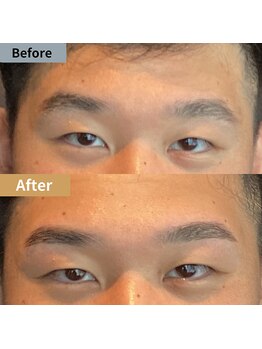 眉毛ハウス 吉祥寺店(眉毛HOUSE)/お客様の施術例(吉祥寺/東京)