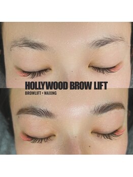 エムエム(mm)/ハリウッドブロウリフト