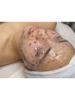 顔脱毛がしたい