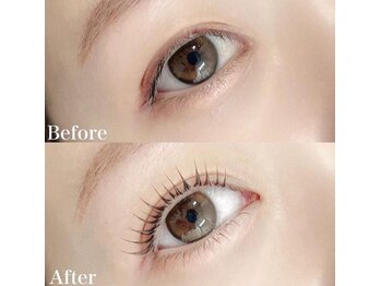 レピア 高槻店/韓国式LEPIA Before&After