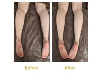 アッファシナンテ(Affascinante)/施術:オリジナル深筋骨メソッド