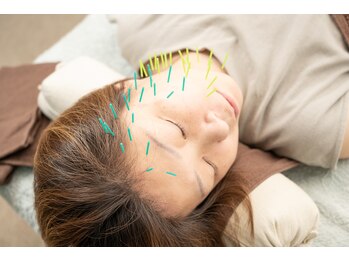 北梅田美容鍼灸院/【大阪/梅田】美容鍼灸