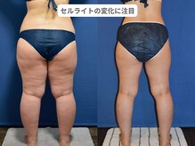 アンシャンテ 神戸元町店(Enchante)/痩身ダイエット　神戸元町三ノ宮