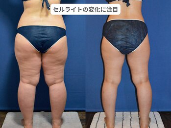 アンシャンテ 神戸元町店(Enchante)/痩身ダイエット　神戸元町三ノ宮