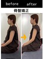 エレヴィザ トウキョウ 恵比寿院(ELVISA TOKYO) 姿勢改善整体/骨盤矯正/恵比寿/東京/渋谷/広尾/小顔矯正