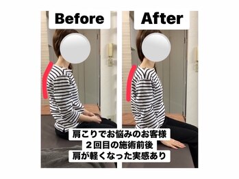 アンティオール 中目黒店/慢性的な肩こり改善整体