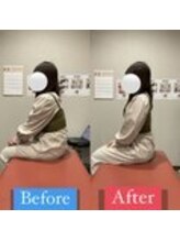 ナオル整体 宮崎院(NAORU整体)/20代女性施術事例【猫背改善】