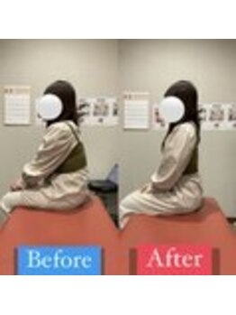ナオル整体 宮崎院(NAORU整体)/20代女性施術事例【猫背改善】