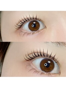 アイラッシュユーリ(Eyelash Juli)の写真/「重いまぶた・逆さまつげ」も解消。目元のコンプレックスを自信に変える技術力。