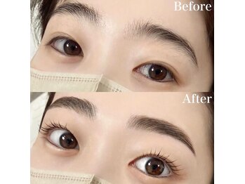 レピア 高槻店/韓国式LEPIA Before&After