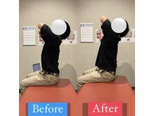 ナオル整体 宮崎院(NAORU整体)/30代男性施術事例【肩こり改善】