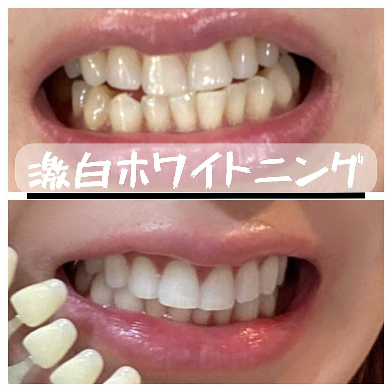 銀座deホワイトニング ｜ホットペッパービューティー