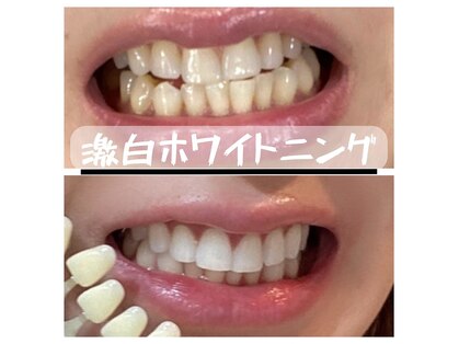 銀座deホワイトニング　の写真
