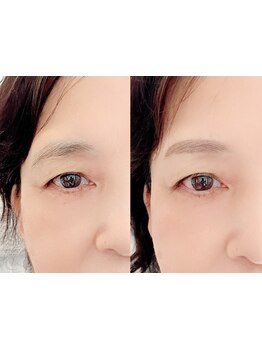 アイブロウメニューがあるサロン