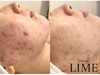 ライム 川崎(LIME)の写真