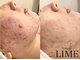 ライム 川崎(LIME)の写真