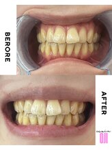 エクシアホワイトニング 王寺店/