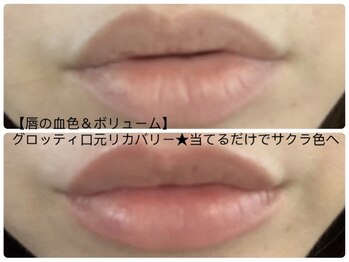 リセラージュ(Recellage)/くすみ縦じわしぼみに◎血管ケア