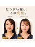 ほうれい線・頬たるみ改善【40代50代人気】小顔矯正60分