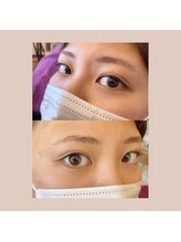 シャンティ(Shanti)/パリジェンヌラッシュリフト